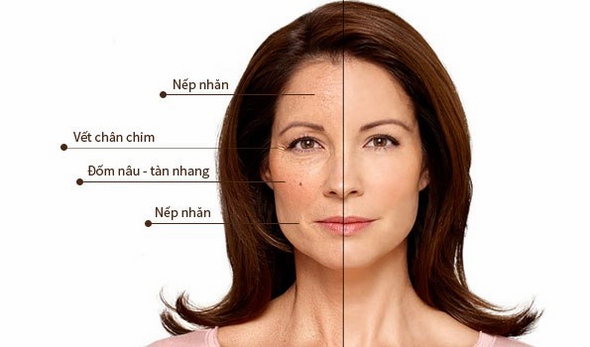 4 cách chữa da mặt bị khô cho phụ nữ sau tuổi 45 – Younger